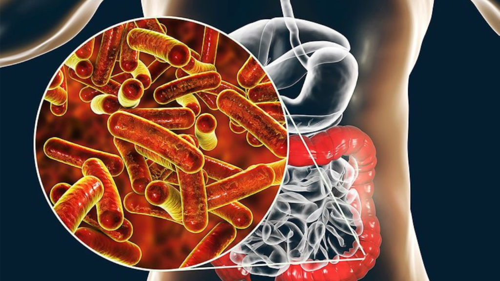 Shigella